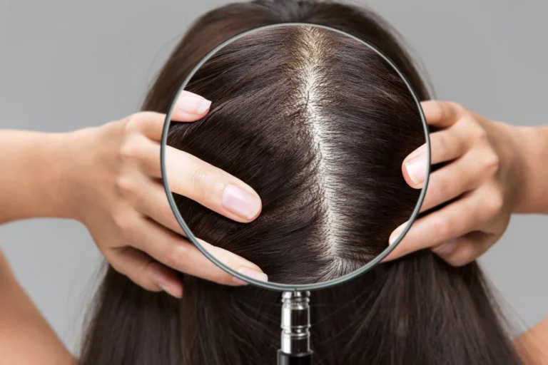scalp microbiome and postbiotics supporting healthy hair growth
