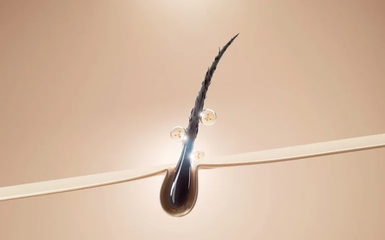 plant exosomes scalp neuro sensory modulation