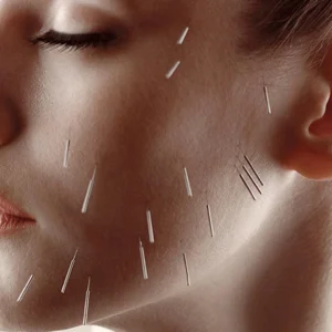 Spicules-220 facial care cosmetic spicules for skin renewal and active penetration